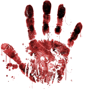 Knife Catching Usually Ends with Bloody Hands